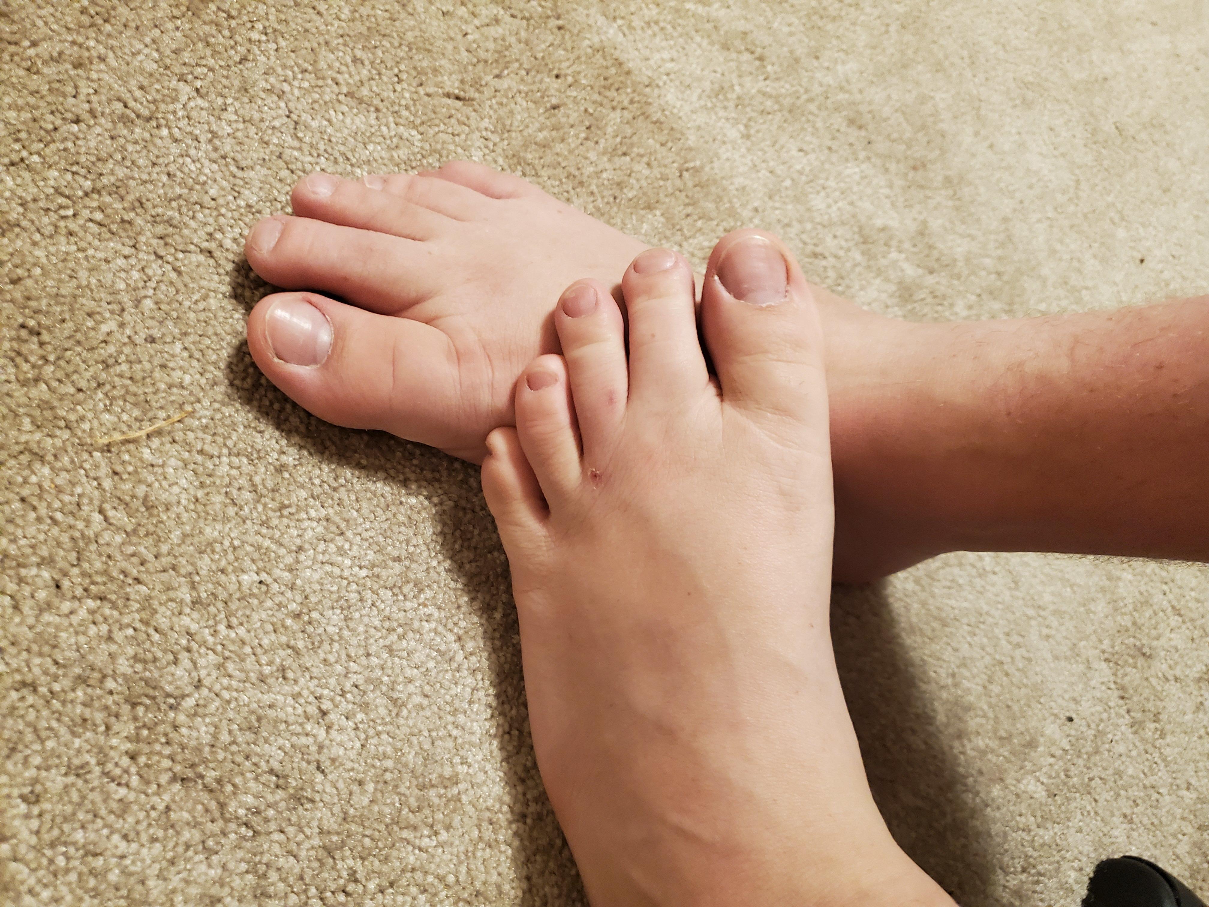 ICT Toes and Feet profile image